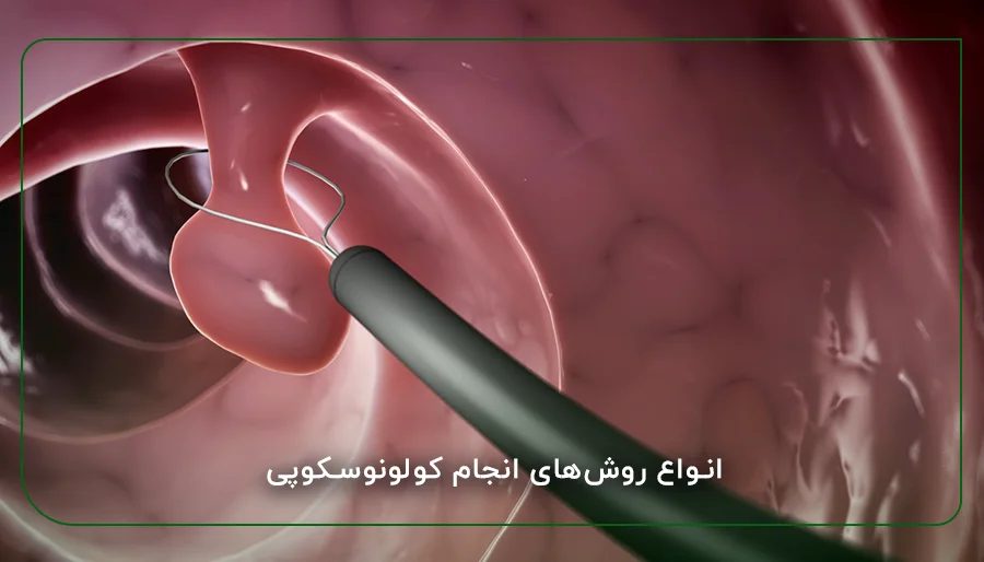 آشنایی با خطرناک ترین مشکلات روده