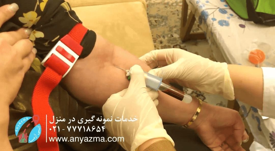 عبور از فاصله خانه تا آزمایشگاه با آنی آزما