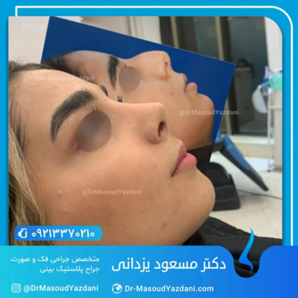 دکتر مسعود یزدانی جراح بینی