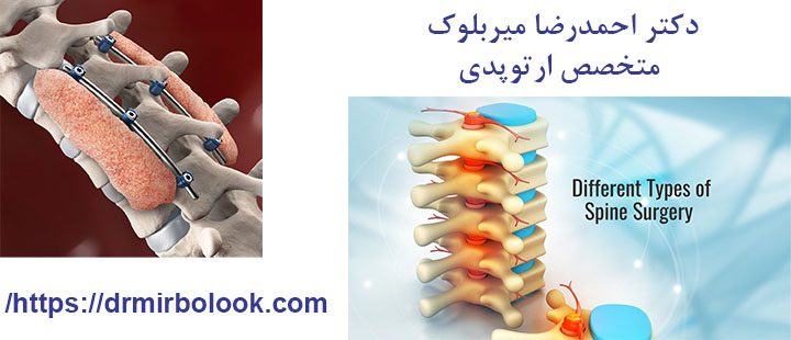 تجربه موفق جراحیهای ستون فقرات با دکتر احمدرضا میربلوک