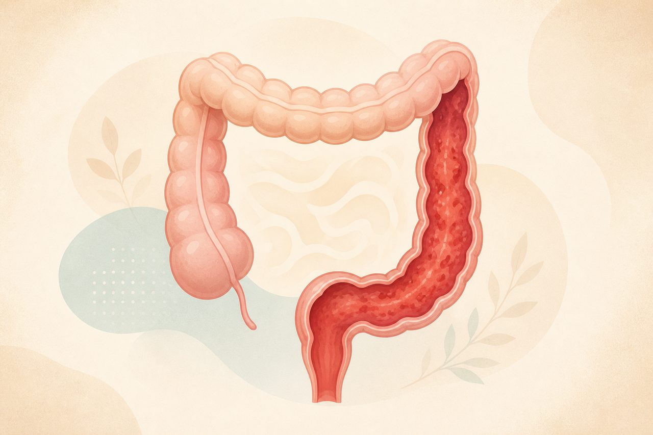 کولیت اولسراتیو چیست؟ علائم، علل و درمان