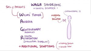 WAGR syndrome