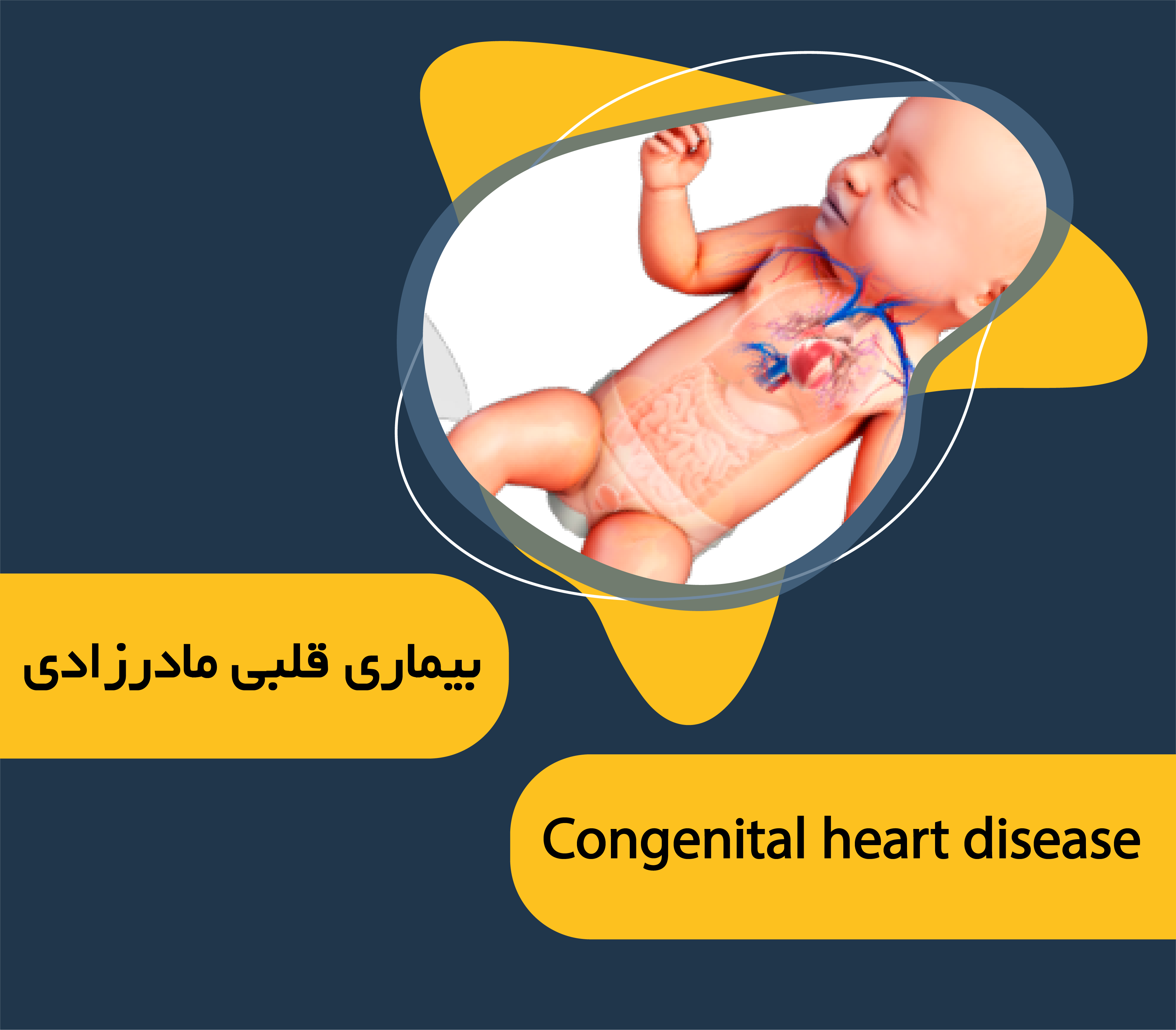 بیماری قلبی مادرزادی در بزرگسالان