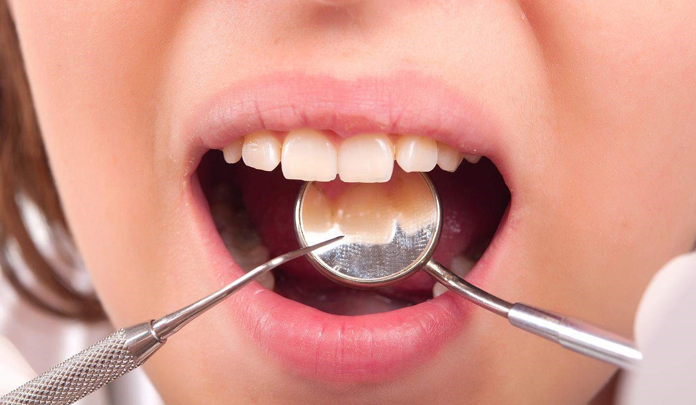 کامپوزیت دندان و بهترین دندانپزشک برای آن