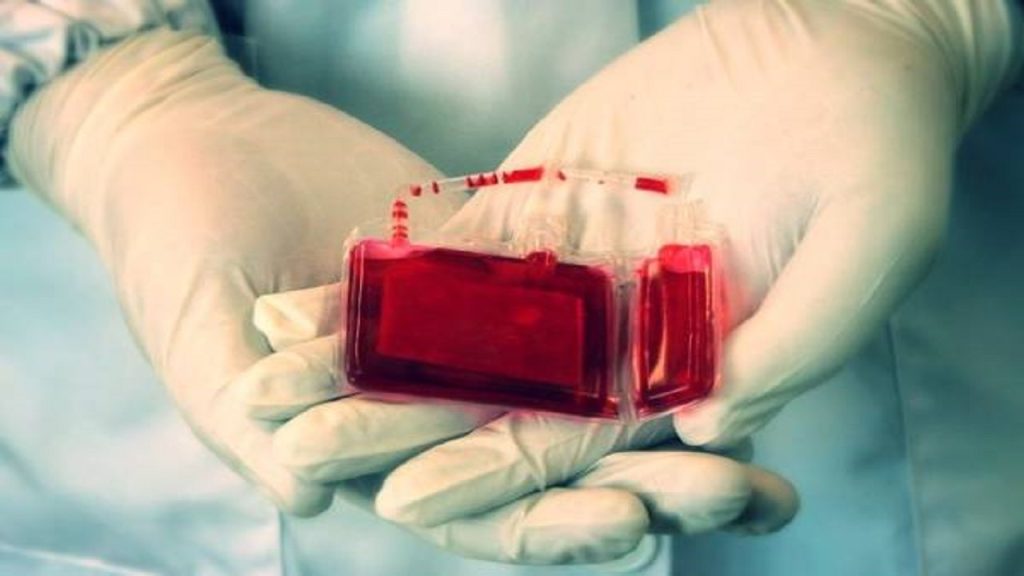 ذخیره سازی بیش از ۱۸۰ هزار نمونه خون بند ناف در کشور