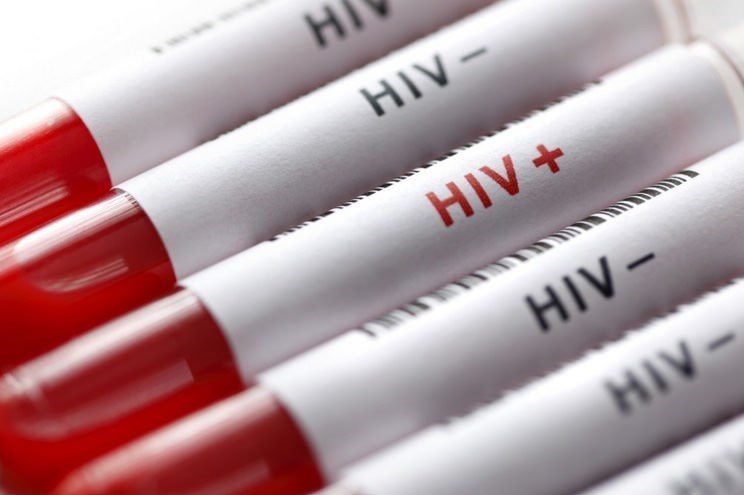 مرگ بیش از ۲۲۰۰۰ بیمار مبتلا به ایدز در کشور تاکنون/ شایع‌ترین راه انتقال HIV