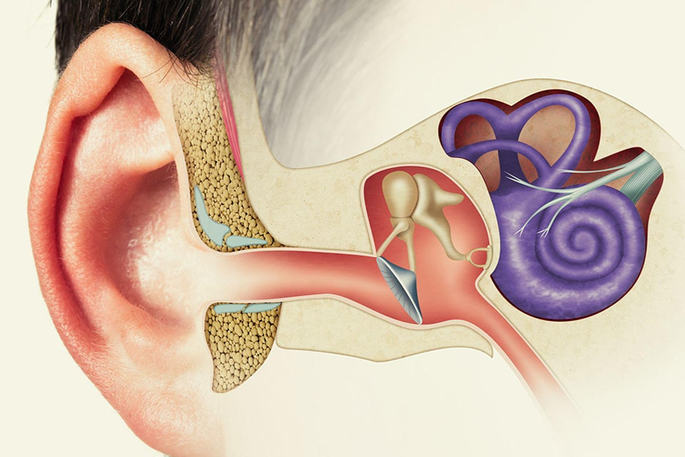 بیماری منیر گوش چیست و چه درمانی دارد؟