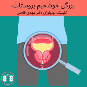 درمان بزرگی پروستات در کلینیک دکتر مهدی قاضی