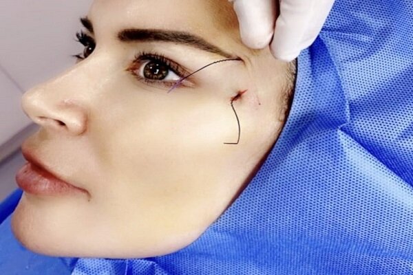 زیبایی روی بند نخ!
