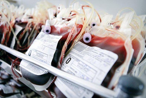 استقرار آزمایشی دستگاه پرتودهی پیشرفته در سازمان انتقال خون ایران
