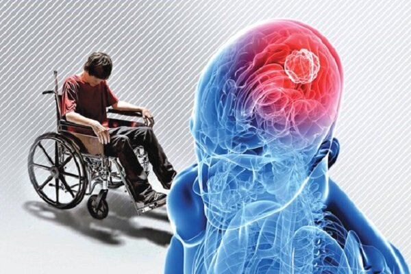 ام‌اس؛ بیماری جوانان با ۱۰ نشانه خاموش