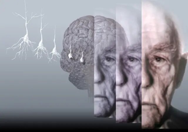 فرمول پیشگیری از آلزایمر