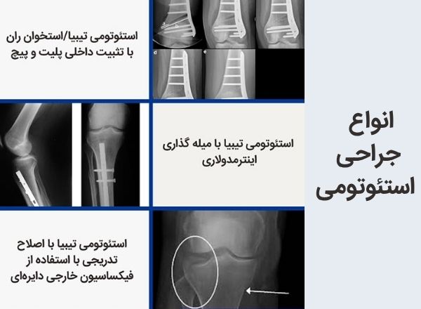 انواع روش های جراحی اصلاحی