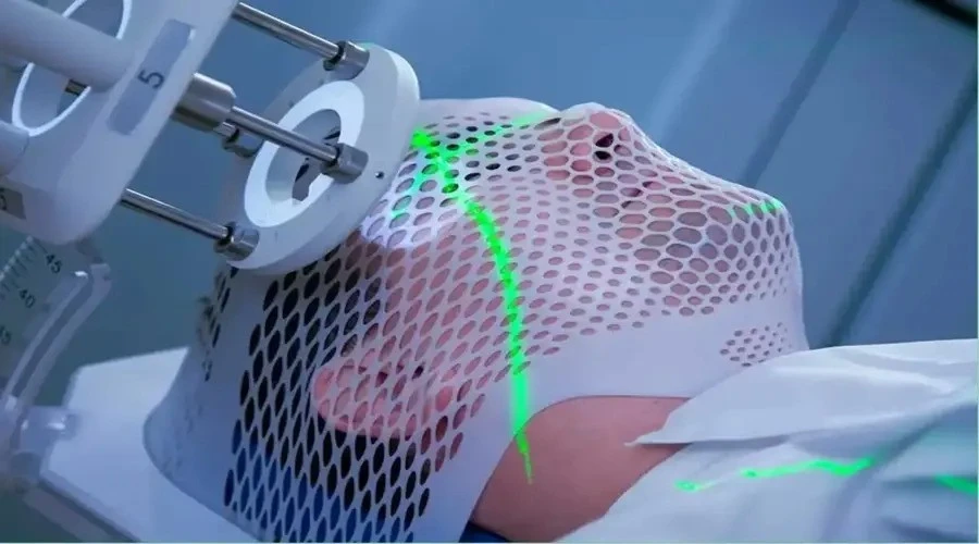 رادیوتراپی سرطان لب و زبان: آنچه که باید درمورد آنها بدانید! - دکتر حسین یحیی زاده