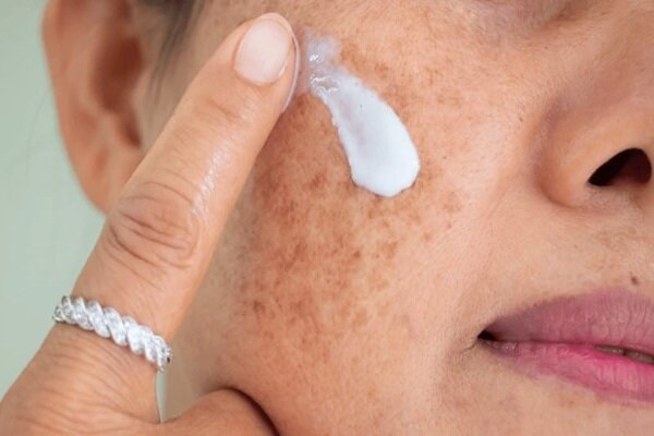 آلودگی هوا و پوست؛ چگونه از التهاب و خطر سرطان پیشگیری کنیم؟