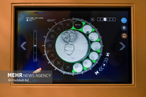 تأثیر مصرف دخانیات و الکل بر بارداری و موفقیت IVF