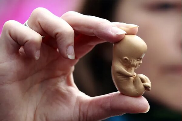 سه ضلع تهدید سلامت جنین و جان مادر