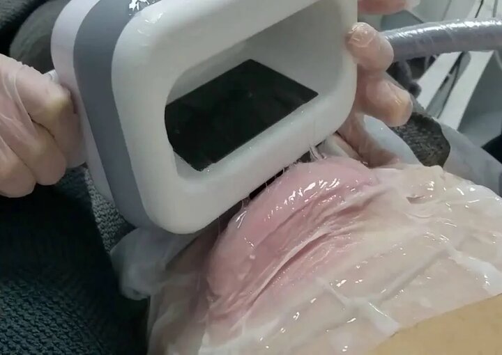 لاغری به هر قیمت؟ از جراحی‌های علمی تا دام تبلیغات اینستاگرامی