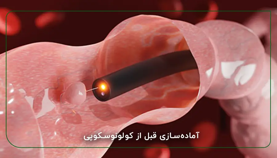 آماده سازی قبل از کولونوسکوپی